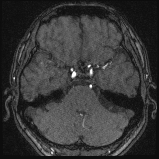 Click on the Serie image to view the images of VILLANUEVA, WILLIAM A.